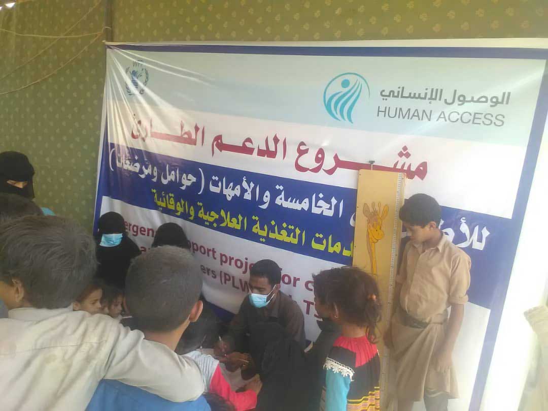 سوء التغذية الحاد الوخيم اليمن