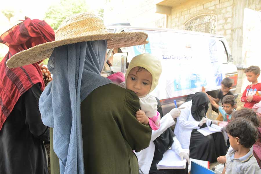 سوء التغذية.. يفتك بأطفال اليمن 